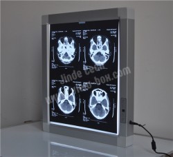 x-ray viewer for E.N.T.