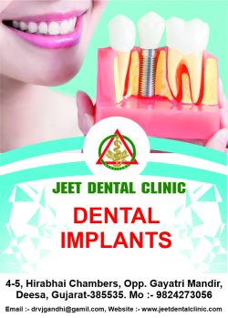 Expert  Dental implants in Deesa
