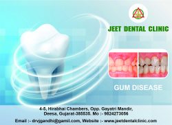Best Gum disease service in Deesa.
