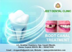 Best dental treatment for root canal in deesa.