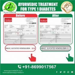Type 1 Diabetes Treatment In Ayurveda