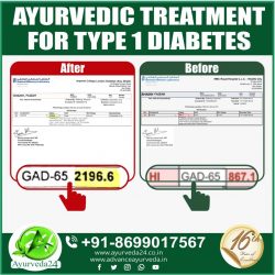 Ayurvedic Treatment for Diabetes