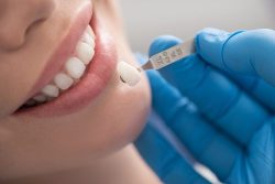 Finding the Best Affordable Cosmetic Dentistry Near Me | Dental Center in Houston TX