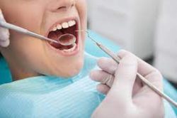 Dental Veneers: How Are They Made? | URBN Dental Midtown | Dentist Houston