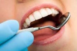 Here’s Why You Should Never Skip Your Dental Cleaning | Dental Clinic on Yale