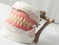 Affordable Partial Dentures in Cypress, TX