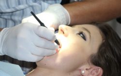 Composite Bonding Near Me | Dental Checkup