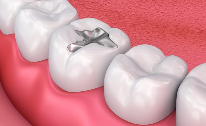 Cosmetic Teeth Bonding Near Me | Telehealth Appointment