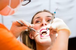 Dental Deep Cleaning Teeth Cost | Dental Bonding