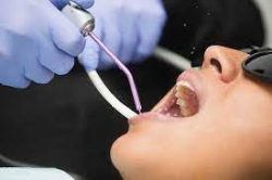 See a Dentist for Teeth Pain Treatment – Emergency Dentist In Houston TX