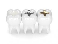 General Dental Services | Teeth Cleaning, Fillings, Crowns