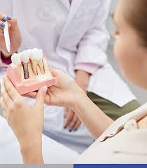 Dental Veneers Near Me | Composite Bonding vs Porcelain Veneers