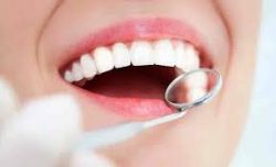 Laser Dental Clinic Houston TX | Laser Dental Surgery Near Me