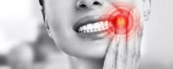 A New Smile with Dental Veneers | Permanent Veneers Procedure