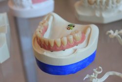 Houston Dentist Open on Saturday – Dental Office Galleria, & River Oaks