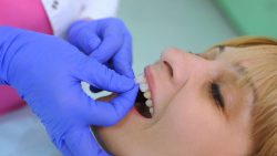 Emergency root canal treatment | Invisalign Cost