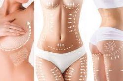 Plastic Surgery Body Contouring Treatments in Marbella