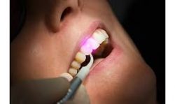 Laser Dentistry In Energy Corridor