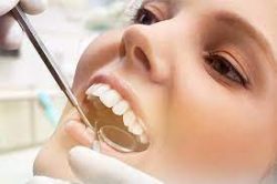 Dental Extraction Near Me