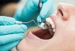 Find Top Dentist Near Me