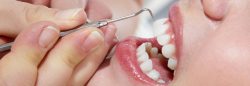 How Much Does a Deep Cleaning Teeth Cost