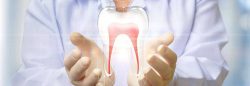 Dental Crown Lengthening Houston | Crown Lengthening Surgery