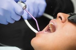 How to Find the Right Dentist for Your Needs? | The Dentist Houston