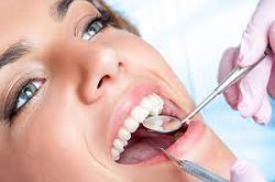 What are Dental Sealants? | Dental Sealant in Houston TX