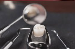 Dental Implants Near Me | Dental Implant Procedure | Implant Dental surgeon