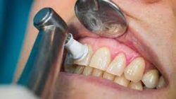 Dentist Open on Saturdays Near Me | Affordable Dental Care in Houston