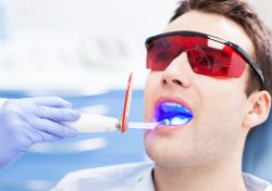 Everything You Need to Know About Laser Dentistry Treatment