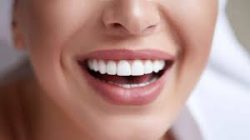 Professional Teeth Whitening | Inlays and Onlays | Implant Restorations