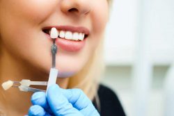 Teeth Whitening Dentist In Houston Heights