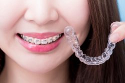 Invisalign Treatment Near Me