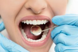 Top 10 Best Delta Dental PPO in Houston, TX | Dentist PPO Near Me