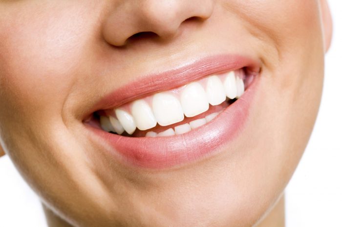 Affordable Veneers Can Give You a New Smile