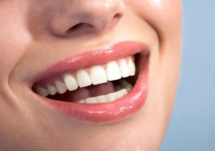 Affordable Dental Implants in Houston