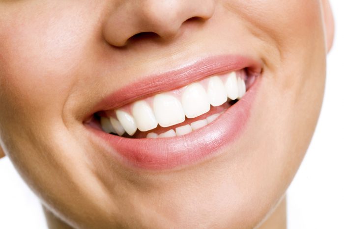 Dental Veneers in Houston, TX