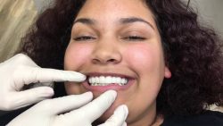 Cosmetic Dentistry Houston, TX