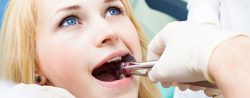 Wisdom Tooth Extraction Dentist Near ME