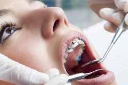 Find Local Braces Dentist Near Me