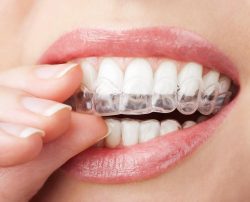 Cosmetic Dentistry Clinic Houston