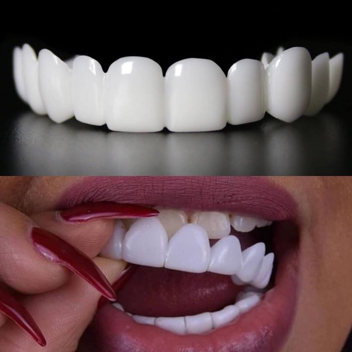 What is Snap-On Smiles?