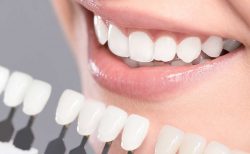 Teeth Whitening Treatment in Houston