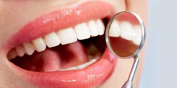 Is Tooth Whitening Midtown Possible For Sensitive Teeth | URBN Dental