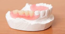 Attractive & Cost-Effective Teeth Replacement Options, Discussed