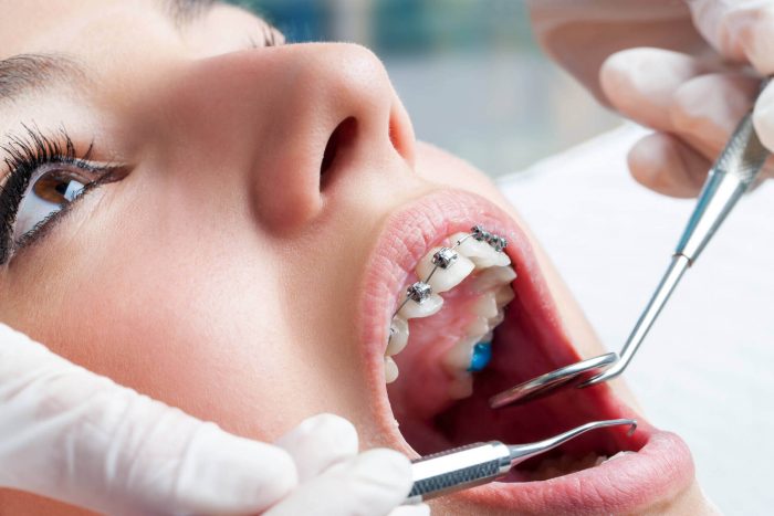 Find The Best Orthodontist In Miami Fl