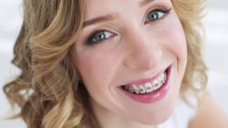 Dental Implants in Surfside, Miami