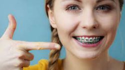 Find Local Orthodontist Near Me For Braces