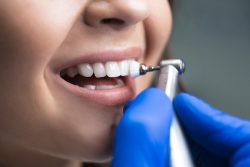 Houston Cosmetic Dentist